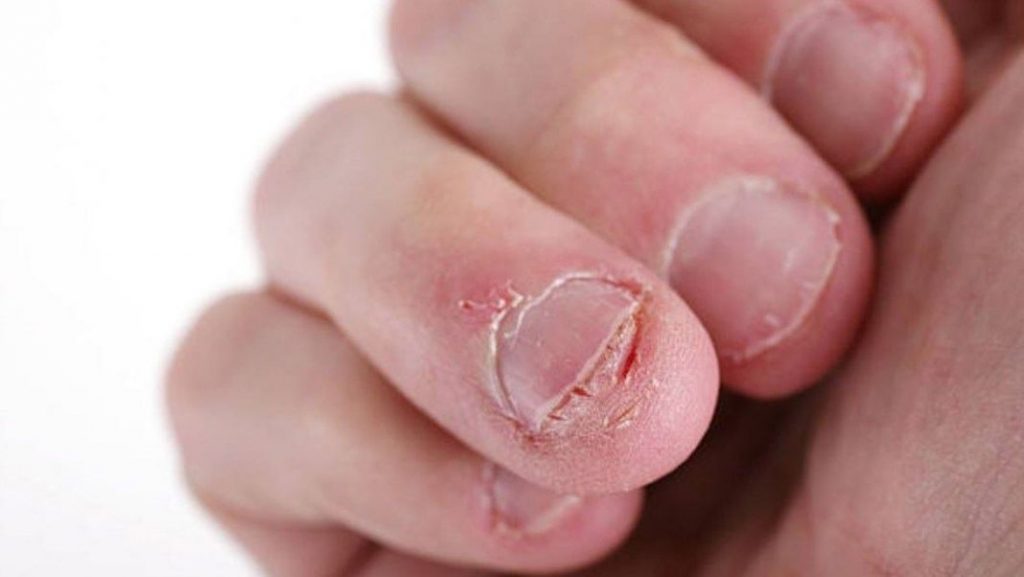 Verdadero o falso: ¿me puede multar la DGT por morderme las uñas? 149 Motor16 Uñas cariñosas
