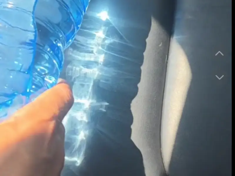 Peligro botella de agua dentro del coche